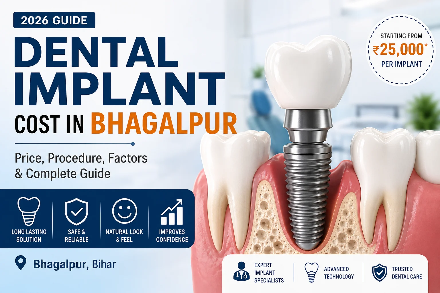 Dental Implant Cost in Bhagalpur Single Tooth Dental Implant Price in Bhagalpur Dental Implant Procedure Step by Step Best Dental Implant Clinic in Bhagalpur Dental Implant Before and After